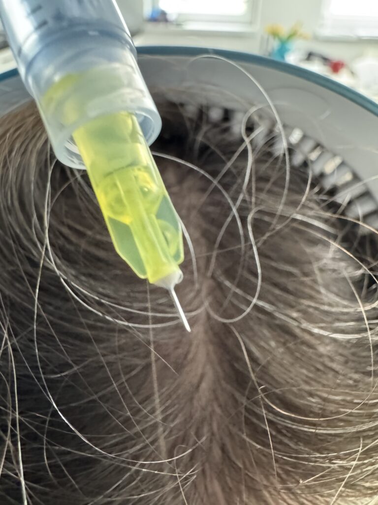 Zabiegi trychologiczne Trycholog Bydgoszcz – Milena Kwaśniewska, specjalizuję się w diagnostyce i leczeniu problemów skóry głowy oraz włosów, oferując profesjonalne konsultacje i indywidualnie dobrane terapie. Nowa 15, 85-119 Bydgoszcz https://milena-trycholog.pl CelltiLab Kosmetyki trychologiczne