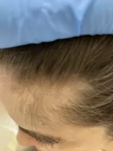 small webp Trycholog Bydgoszcz – Milena Kwaśniewska, specjalizuję się w diagnostyce i leczeniu problemów skóry głowy oraz włosów, oferując profesjonalne konsultacje i indywidualnie dobrane terapie. Nowa 15, 85-119 Bydgoszcz https://milena-trycholog.pl
