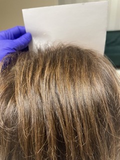 small webp Trycholog Bydgoszcz – Milena Kwaśniewska, specjalizuję się w diagnostyce i leczeniu problemów skóry głowy oraz włosów, oferując profesjonalne konsultacje i indywidualnie dobrane terapie. Nowa 15, 85-119 Bydgoszcz https://milena-trycholog.pl