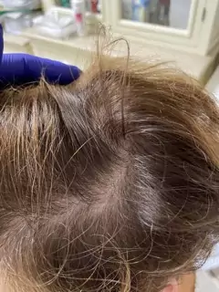small webp Trycholog Bydgoszcz – Milena Kwaśniewska, specjalizuję się w diagnostyce i leczeniu problemów skóry głowy oraz włosów, oferując profesjonalne konsultacje i indywidualnie dobrane terapie. Nowa 15, 85-119 Bydgoszcz https://milena-trycholog.pl