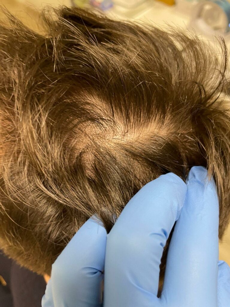 Trycholog Bydgoszcz – Milena Kwaśniewska, specjalizuję się w diagnostyce i leczeniu problemów skóry głowy oraz włosów, oferując profesjonalne konsultacje i indywidualnie dobrane terapie. Nowa 15, 85-119 Bydgoszcz https://milena-trycholog.pl